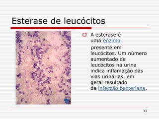 13
Esterase de leucócitos
 A esterase é
uma enzima
presente em
leucócitos. Um número
aumentado de
leucócitos na urina
indica inflamação das
vias urinárias, em
geral resultado
de infecção bacteriana.
 