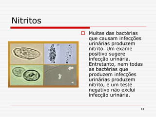 14
Nitritos
 Muitas das bactérias
que causam infecções
urinárias produzem
nitrito. Um exame
positivo sugere
infecção urinária.
Entretanto, nem todas
as bactérias que
produzem infecções
urinárias produzem
nitrito, e um teste
negativo não exclui
infecção urinária.
 