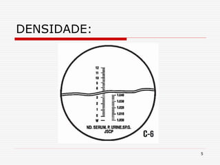5
DENSIDADE:
 
