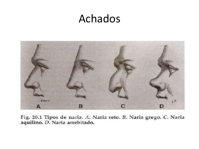Exame de nariz
