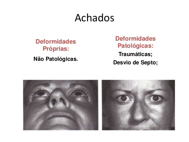 Exame de nariz