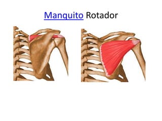 Manquito Rotador
 
