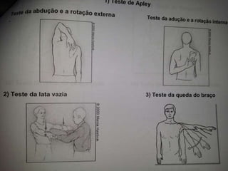 Exame do ombro