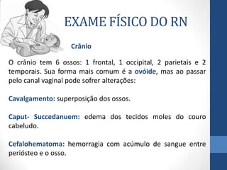 EXAME FÍSICO DO RN
O crânio tem 6 ossos: 1 frontal, 1 occipital, 2 parietais e 2
temporais. Sua forma mais comum é a ovóide, mas ao passar
pelo canal vaginal pode sofrer alterações:
Cavalgamento: superposição dos ossos.
Caput- Succedanuem: edema dos tecidos moles do couro
cabeludo.
Cefalohematoma: hemorragia com acúmulo de sangue entre
periósteo e o osso.
Crânio
 