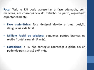 Face: Todo o RN pode apresentar a face edemacia, com
manchas, em consequência do trabalho de parto, regredindo
espontaneamente.
• Face assimétrica: face desigual devido a uma posição
desigual na vida fetal.
• Millium Facial ou sebáceo: pequenos pontos brancos na
região frontal e nasal (1º mês).
• Estrabismo: o RN não consegue coordenar o globo ocular,
podendo persistir até o 6º mês.
 