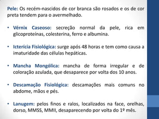 Pele: Os recém-nascidos de cor branca são rosados e os de cor
preta tendem para o avermelhado.
• Vérnix Caseoso: secreção normal da pele, rica em
glicoproteínas, colesterina, ferro e albumina.
• Icterícia Fisiológica: surge após 48 horas e tem como causa a
imaturidade das células hepáticas.
• Mancha Mongólica: mancha de forma irregular e de
coloração azulada, que desaparece por volta dos 10 anos.
• Descamação Fisiológica: descamações mais comuns no
abdome, mãos e pés.
• Lanugem: pelos finos e ralos, localizados na face, orelhas,
dorso, MMSS, MMII, desaparecendo por volta do 1º mês.
 