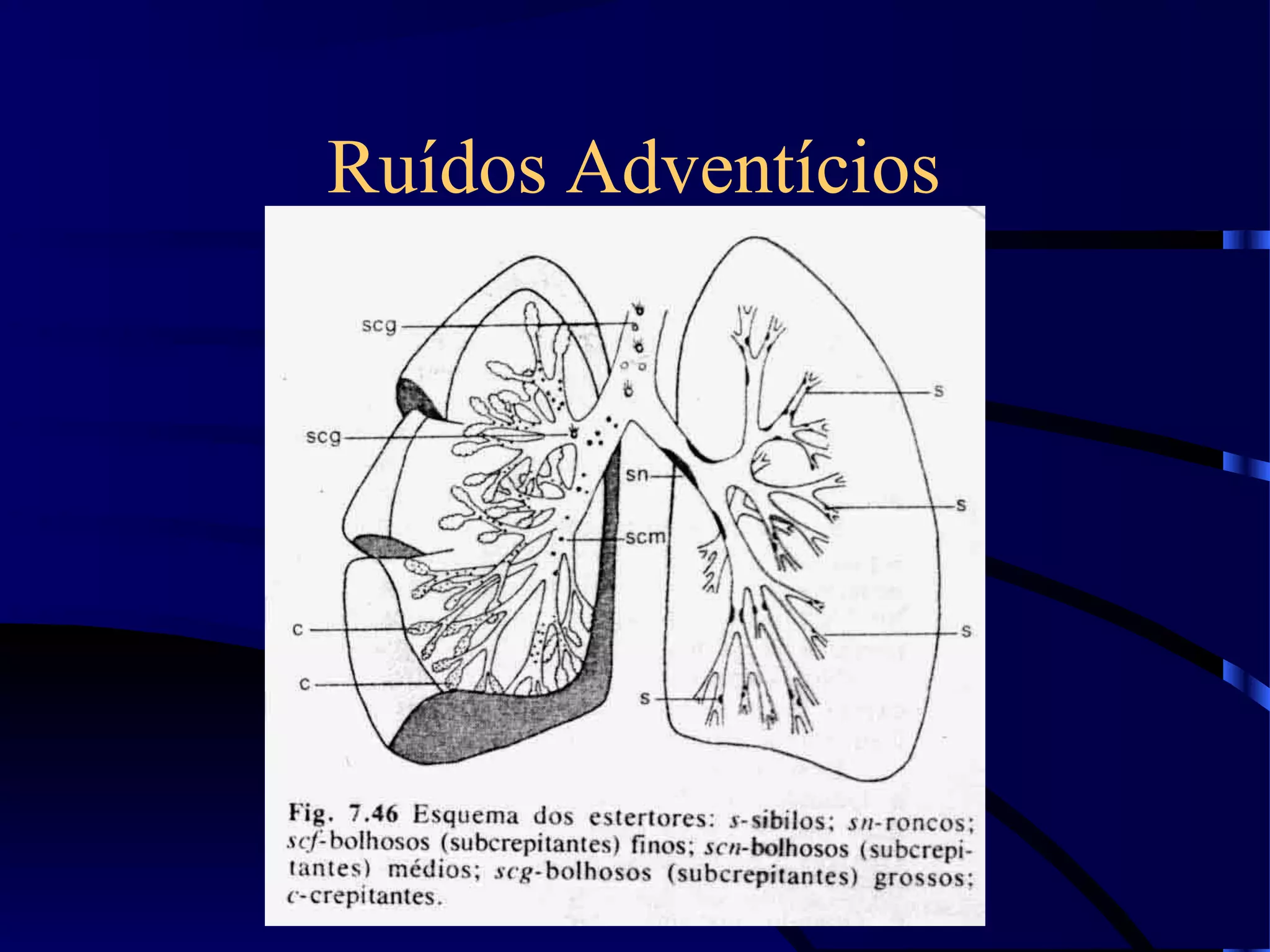 Ruídos Adventícios
 