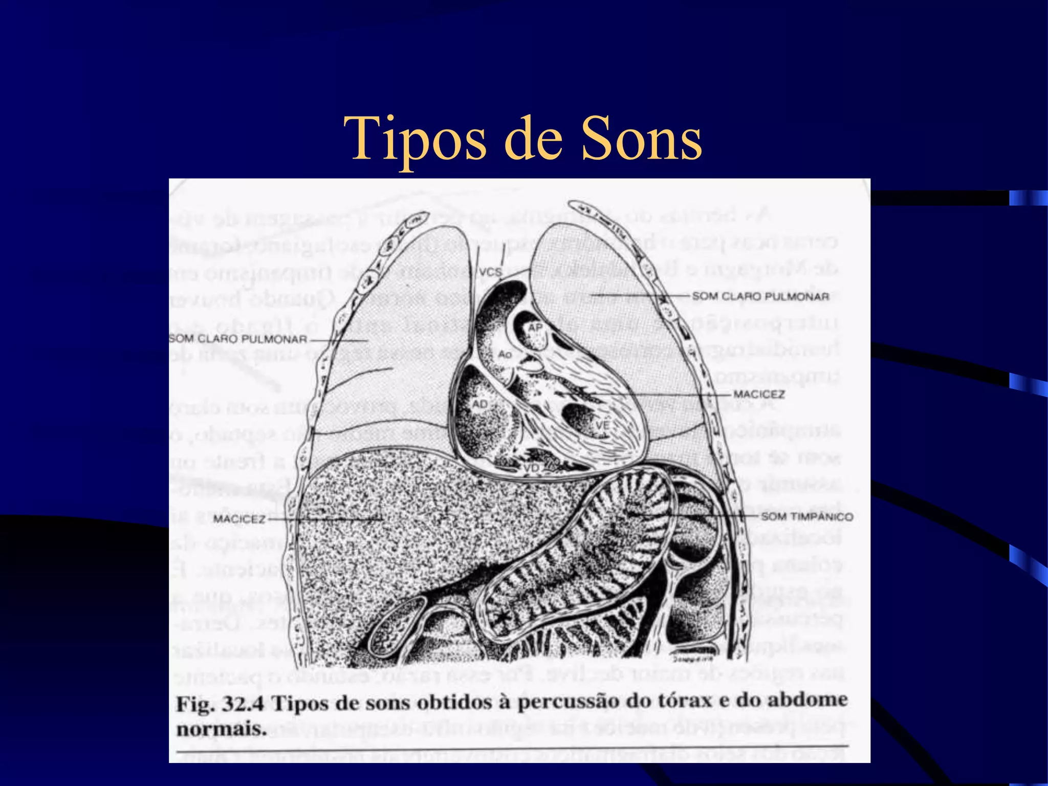 Tipos de Sons
 