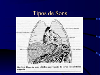 Tipos de Sons
 
