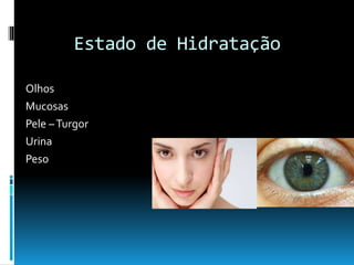 Estado de Hidratação
Olhos
Mucosas
Pele –Turgor
Urina
Peso
 