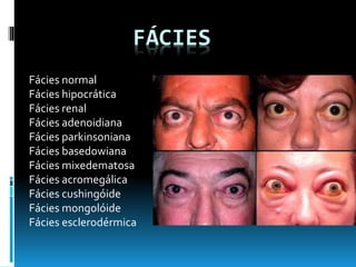 FÁCIES
Fácies normal
Fácies hipocrática
Fácies renal
Fácies adenoidiana
Fácies parkinsoniana
Fácies basedowiana
Fácies mixedematosa
Fácies acromegálica
Fácies cushingóide
Fácies mongolóide
Fácies esclerodérmica
 