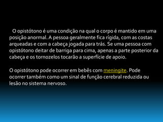 O opistótono é uma condição na qual o corpo é mantido em uma
posição anormal.A pessoa geralmente fica rígida, com as costas
arqueadas e com a cabeça jogada para trás. Se uma pessoa com
opistótono deitar de barriga para cima, apenas a parte posterior da
cabeça e os tornozelos tocarão a superfície de apoio.
O opistótono pode ocorrer em bebês com meningite. Pode
ocorrer também como um sinal de função cerebral reduzida ou
lesão no sistema nervoso.
 