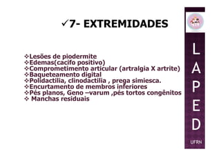 7- EXTREMIDADES
Lesões de piodermite
Edemas(cacifo positivo)
Comprometimento articular (artralgia X artrite)
Baqueteamento digital
Polidactilia, clinodactilia , prega simiesca.
L
A
P
Baqueteamento digital
Polidactilia, clinodactilia , prega simiesca.
Encurtamento de membros inferiores
Pés planos, Geno –varum ,pés tortos congênitos
Manchas residuais
P
E
D
UFRN
 
