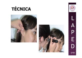 TÉCNICA
L
A
PP
E
D
UFRN
 