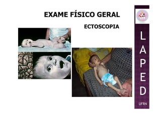 EXAME FÍSICO GERAL
ECTOSCOPIA
L
A
PP
E
D
UFRN
 