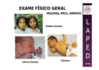 EXAME FÍSICO GERAL
MUCOSA, PELE, ANEXOS
Palidez-Anemia
L
A
P
(Acro) Cianose
Icterícia
P
E
D
UFRN
 