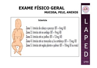 EXAME FÍSICO GERAL
MUCOSA, PELE, ANEXOS
Icterícia
L
A
P
Icterícia
P
E
D
UFRN
 