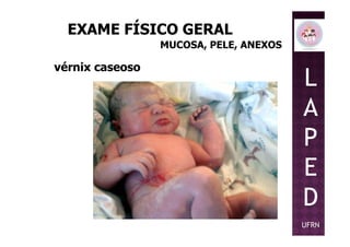 EXAME FÍSICO GERAL
MUCOSA, PELE, ANEXOS
vérnix caseoso
L
A
PP
E
D
UFRN
 