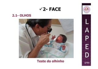 2- FACE
2.1- OLHOS
L
A
PP
E
D
UFRN
Teste do olhinho
 