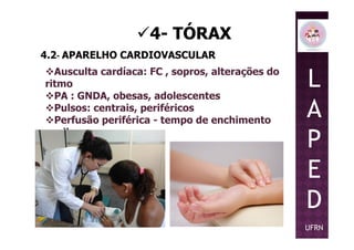 4- TÓRAX
4.2- APARELHO CARDIOVASCULAR
Ausculta cardíaca: FC , sopros, alterações do
ritmo
PA : GNDA, obesas, adolescentes
Pulsos: centrais, periféricos
Perfusão periférica - tempo de enchimento
L
A
P
Perfusão periférica - tempo de enchimento
capilar
P
E
D
UFRN
 