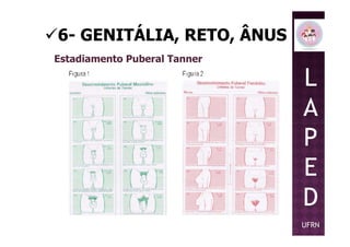 6- GENITÁLIA, RETO, ÂNUS
Estadiamento Puberal Tanner
L
A
PP
E
D
UFRN
 