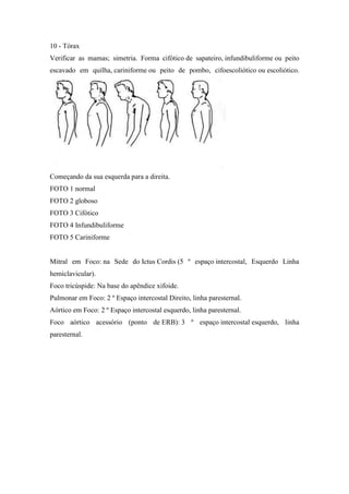 10 - Tórax
Verificar as mamas; simetria. Forma cifótico de sapateiro, infundibuliforme ou peito
escavado em quilha, cariniforme ou peito de pombo, cifoescoliótico ou escoliótico.




Começando da sua esquerda para a direita.
FOTO 1 normal
FOTO 2 globoso
FOTO 3 Cifótico
FOTO 4 Infundibuliforme
FOTO 5 Cariniforme


Mitral em Foco: na Sede do Ictus Cordis (5 º espaço intercostal, Esquerdo Linha
hemiclavicular).
Foco tricúspide: Na base do apêndice xifoide.
Pulmonar em Foco: 2 º Espaço intercostal Direito, linha paresternal.
Aórtico em Foco: 2 º Espaço intercostal esquerdo, linha paresternal.
Foco aórtico acessório (ponto de ERB): 3 º espaço intercostal esquerdo, linha
paresternal.
 