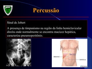 Percussão Sinal de Jobert A presença de timpanismo na região da linha hemiclavicular direita onde normalmente se encontra macicez hepática, caracteriza pneumoperitônio. T6-T12 