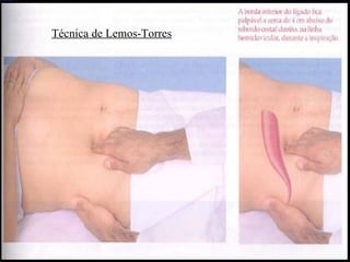Técnica de Lemos-Torres 