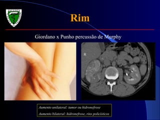 Rim Giordano x Punho percussão de Murphy Aumento unilateral: tumor ou hidronefrose Aumento bilateral: hidronefrose, rins policísticos 