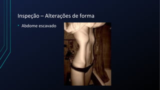 Inspeção – Alterações de forma
• Abdome escavado
 