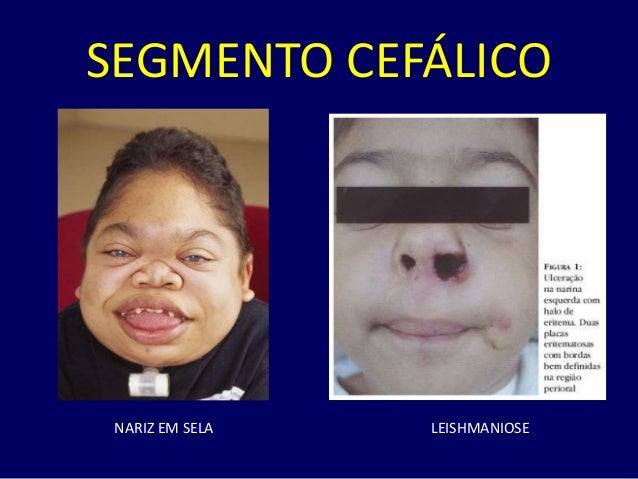Exame de nariz