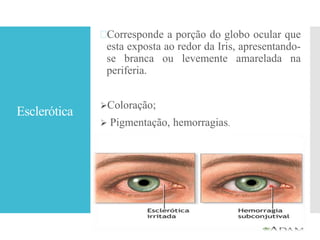 Esclerótica
Corresponde a porção do globo ocular que
esta exposta ao redor da Iris, apresentando-
se branca ou levemente amarelada na
periferia.
Coloração;
 Pigmentação, hemorragias.
 