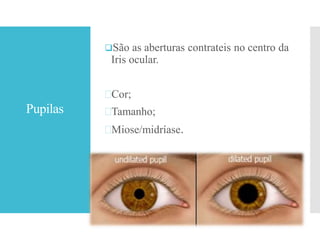 Pupilas
São as aberturas contrateis no centro da
Iris ocular.
Cor;
Tamanho;
Miose/midríase.
 