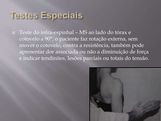  Teste do infra-espinhal – MS ao lado do tórax e
cotovelo a 90°, o paciente faz rotação externa, sem
mover o cotovelo, contra a resistência, também pode
apresentar dor associada ou não a diminuição de força
e indicar tendinites, lesões parciais ou totais do tensão.
 