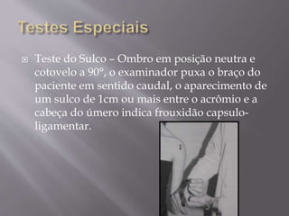  Teste do Sulco – Ombro em posição neutra e
cotovelo a 90°, o examinador puxa o braço do
paciente em sentido caudal, o aparecimento de
um sulco de 1cm ou mais entre o acrômio e a
cabeça do úmero indica frouxidão capsulo-
ligamentar.
 