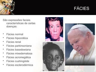 FÁCIES
São expressões faciais
características de certas
doenças:
• Fácies normal
• Fácies hipocrática
• Fácies renal
• Fácies parkinsoniana
• Fácies basedowiana
• Fácies mixedematosa
• Fácies acromegálica
• Fácies cushingóide
• Fácies esclerodérmica
 