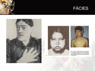 FÁCIES
 