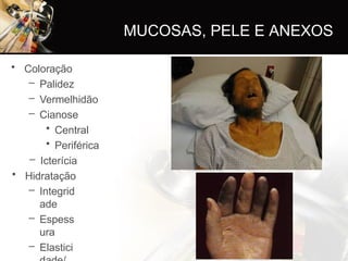 • Coloração
– Palidez
– Vermelhidão
– Cianose
• Central
• Periférica
– Icterícia
• Hidratação
– Integrid
ade
– Espess
ura
– Elastici
MUCOSAS, PELE E ANEXOS
 