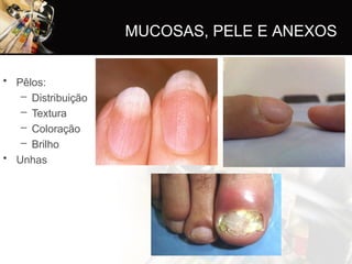 • Pêlos:
– Distribuição
– Textura
– Coloração
– Brilho
• Unhas
MUCOSAS, PELE E ANEXOS
 