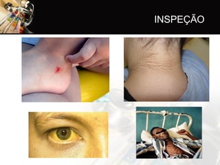 INSPEÇÃO
 