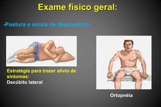 Exame físico geral:
-Postura e sinais de desconforto:
Estratégia para trazer alívio de
sintomas:
Decúbito lateral
Ortopnéia
 