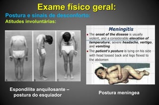 Exame físico geral:
Postura e sinais de desconforto:
Atitudes involuntárias:
Espondilite anquilosante –
postura do esquiador Postura meníngea
 