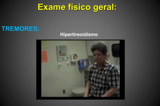 Exame físico geral:
TREMORES:
Hipertireoidismo
 
