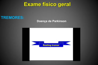 Exame físico geral
TREMORES:
Doença de Parkinson
 