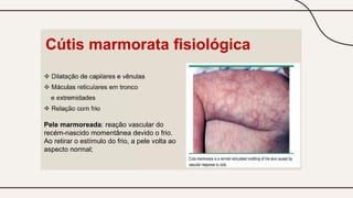 exame-fisico-neonatal-tecnico-de-enfermagem-1-pptx