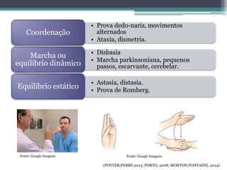 Fonte: Google ImagensFonte: Google Imagens
(POTTER;PERRY,2013; PORTO, 2008; MORTON;FONTAINE, 2014)
• Prova dedo-nariz, movimentos
alternados
• Ataxia, dismetria.
Coordenação
• Disbasia
• Marcha parkinsoniana, pequenos
passos, escarvante, cerebelar.
Marcha ou
equilíbrio dinâmico
• Astasia, distasia.
• Prova de Romberg.
Equilíbrio estático
 