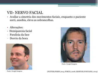 VII- NERVO FACIAL
• Avaliar a simetria dos movimentos faciais, enquanto o paciente
sorri, assobia, eleva as sobrancelhas.
• Alterações:
- Hemiparesia facial
- Paralisia da face
- Desvio da boca
Fonte: Google Imagens
Fonte: Google Imagens
(POTTER;PERRY,2013; PORTO, 2008; MORTON;FONTAINE, 2014)
 