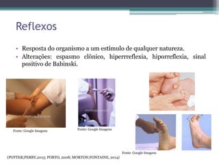 Reflexos
• Resposta do organismo a um estímulo de qualquer natureza.
• Alterações: espasmo clônico, hiperrreflexia, hiporreflexia, sinal
positivo de Babinski.
Fonte: Google Imagens
Fonte: Google Imagens Fonte: Google Imagens
(POTTER;PERRY,2013; PORTO, 2008; MORTON;FONTAINE, 2014)
 