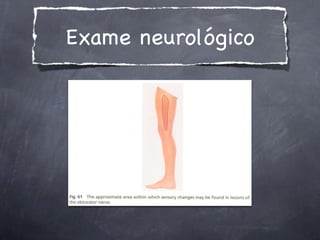 Exame neurológico
 