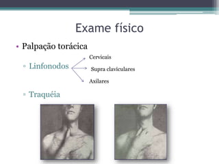 Exame físico
• Palpação torácica
▫ Linfonodos
▫ Traquéia
Cervicais
Supra claviculares
Axilares
 